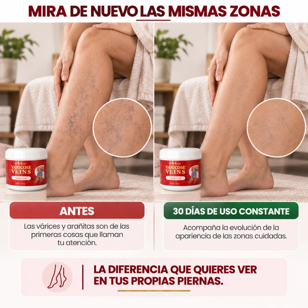 SOUTH MOON™ Crema Especializada para Várices y Arañitas