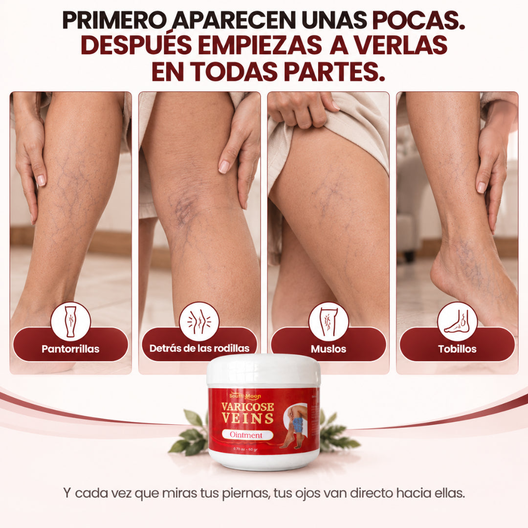 SOUTH MOON™ Crema Especializada para Várices y Arañitas