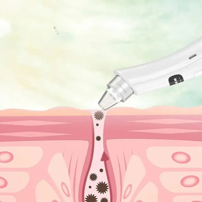 Máquina de limpieza facial